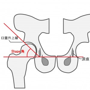 年齢とともにShape角がなくなります