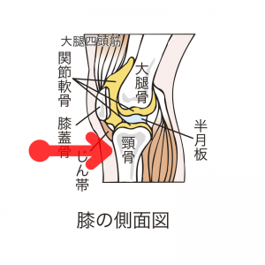 痛みが出る箇所（赤い矢印）