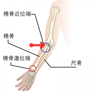 痛みの場所：赤い矢印（肘の外側）