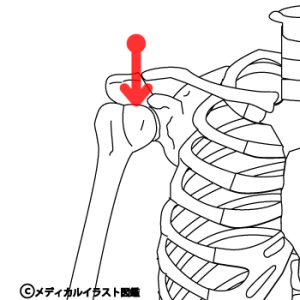 赤い矢印（腕の付け根）に負担がかかる